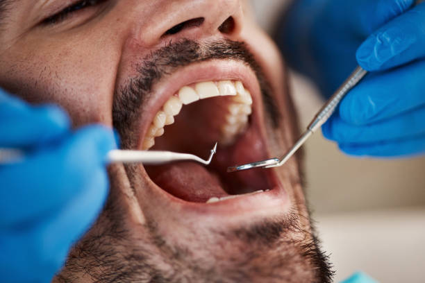 Best Emergency Broken Tooth Repair in Leupp, AZ
